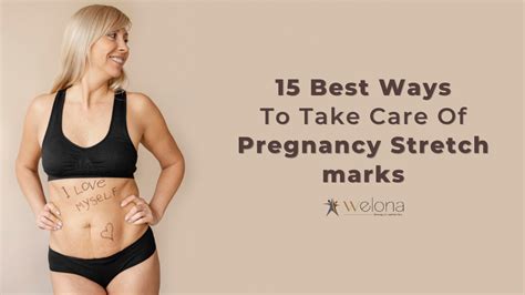 15 Best Ways To Take Care Of Pregnancy Stretch Marks Welona