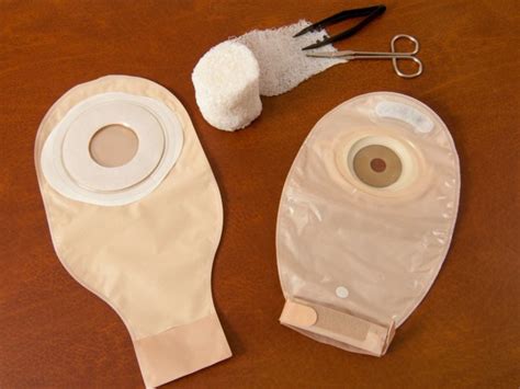 Ostomy Care Type Risk Recovery Time And Clinical Procedures