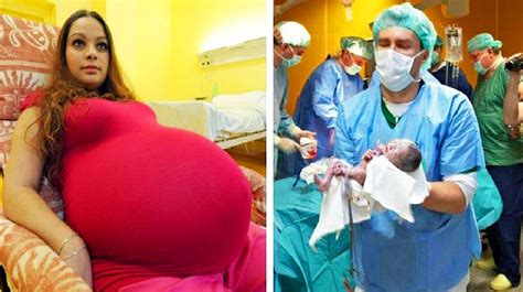Mother Believes She Was Giving Birth To Twins Then The Docs Realize
