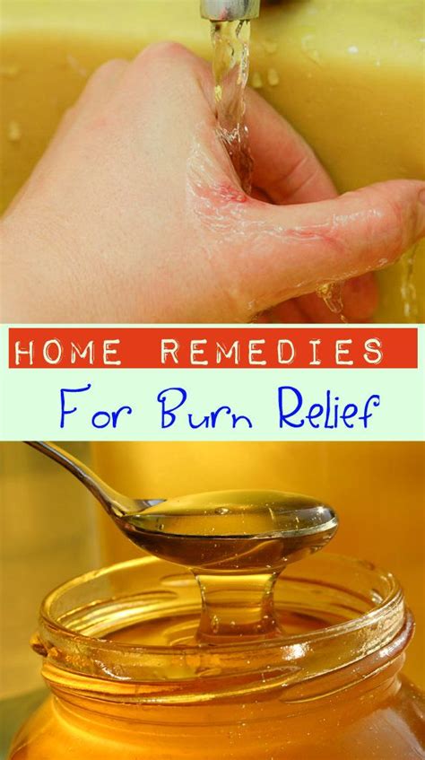 Surprising Home Remedies For Burns How To Treat A Burn