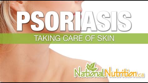 Natural Health Reviews Psoriasis Youtube