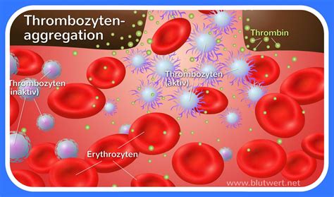 Von der norm abweichende werte können auf verschiedene entzündungen und erkrankungen hindeuten. Thrombozyten (Blutplättchen)