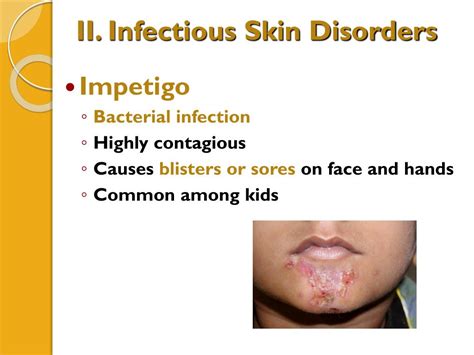 Ppt Integumentary System Part 2 Skin Disorders Powerpoint
