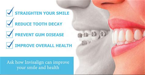 Amazing Benefits Of Invisalign Wbccstar Invisalign Dentist