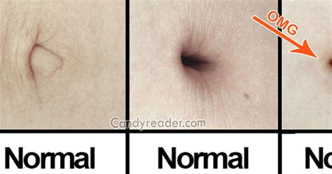 OMG Bizarre Facts About Belly Button You Cannot Even Imagine The Discover Reality