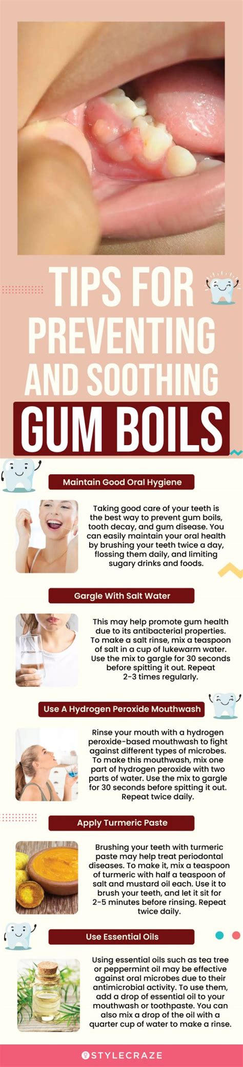 Gum Boil Symptoms Natural Remedies And Medication