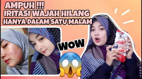 Cara Mengatasi Iritasi Wajah akibat penggunakan skin care ...