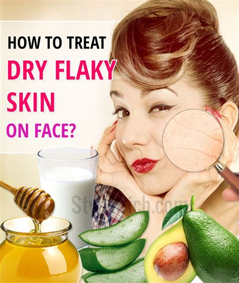 How To Treat Dry Flaky Skin On Face Stylenrich