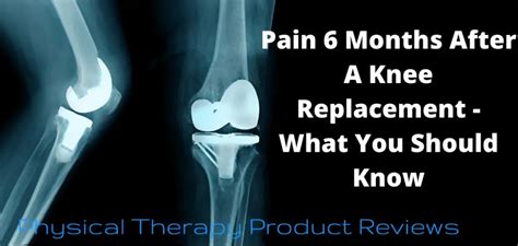 Pain Months After A Knee Replacement What You Should Know Best