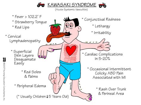 Nursing Mnemonics And Tips Kawasaki Disease Blood Vessels And Scary