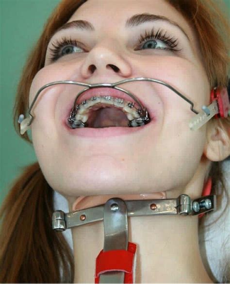 Braces Fetish Headgear Hot Naked Pics Comments