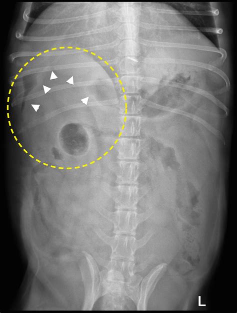 The Role Of Imaging In Diagnosing Pancreatitis Mspca Angell