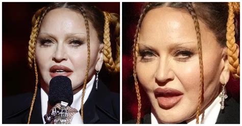 Madonna Ai Grammy Si Presenta Con Il Viso Deformato Fan Preoccupati