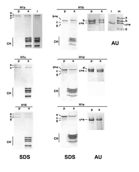 Perturbation Of The H1 Complement Of Native Chromatin A Sample Of Download Scientific Diagram