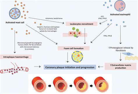 Role Of Allergic Inflammatory Cells In Coronary Artery Disease
