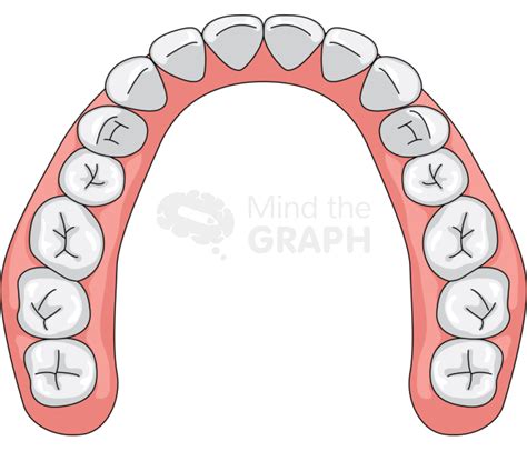Dental Arch Upper