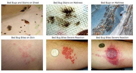 Bed Bugs Treatment Products Instructions Tips And Advice
