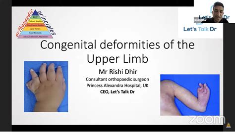 Management Of Spasticity In The Upper Limb Orthopaedi