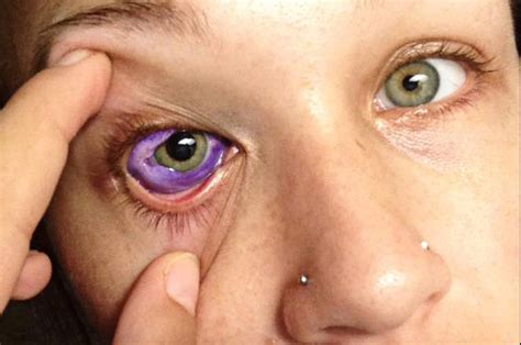 Newborn pups cannot regulate their body temperature and are not very mobile, they may not be if your newborn puppy is crying a lot, it may be a sign of the lack of warmth she is feeling. Eye Diseases A to Z-all for your vision - Healthpulls