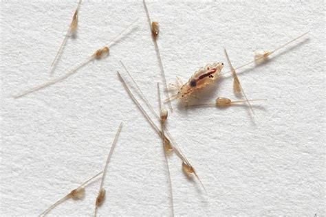 Head Lice Pictures What Do Head Lice Louse Nits And Eggs Look Like