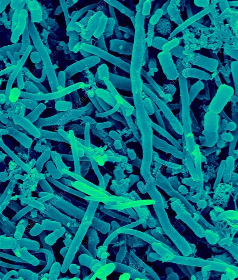Human Oral Bacteria Sem Stock Image C0322310 Science Photo Library
