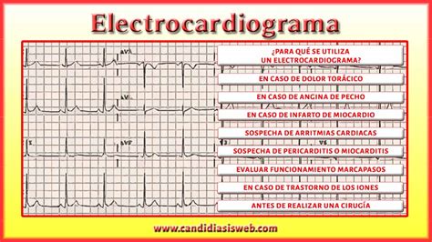 Como Leer Un Electrocardiograma Electrocardiograma Ap Vrogue Co