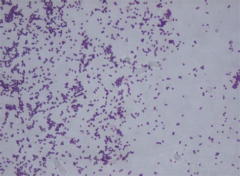Staphylococcus Saprophyticus Microbiology Medbullets Step 1