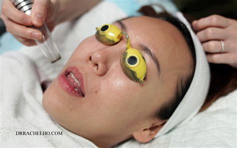 Dr Rachel Ho 10 Things To Know Before Having Lasers For Your Pigmentation