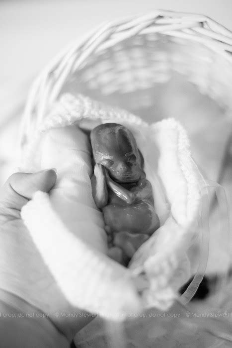 Mother Shares Moving Photos Of Baby Miscarried At 15 Weeks He Was A Person