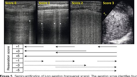 Lung Ultrasound For Critically Ill Patients Semantic Scholar