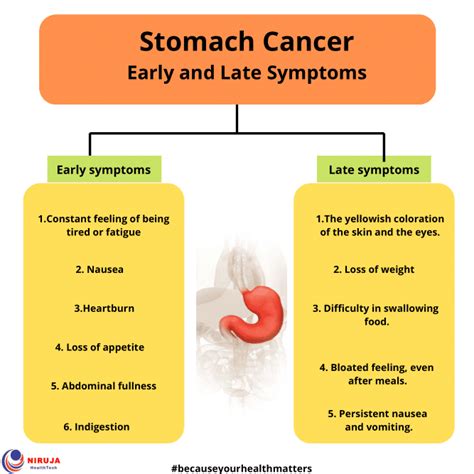 What Are Early Signs Of Stomach Cancer Early Warning Signs Of Stomach Cancer Wear Indigestion Heartburn Or Symptoms Similar To An Ulcer May Be Signs Of A Stomach Tumor