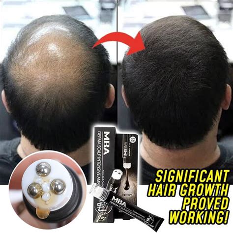 scalp intense roll on hair growth serum triple roll massager fast