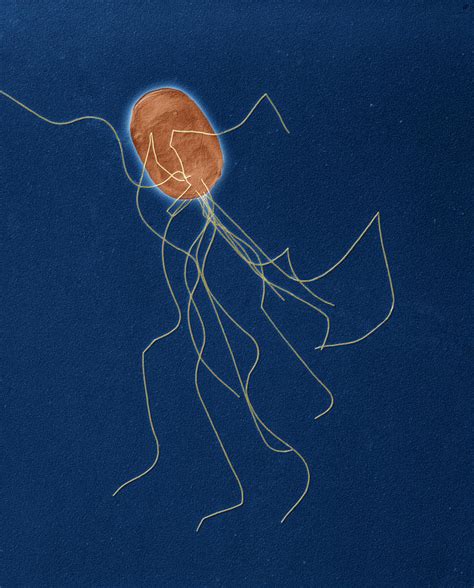 Proteus Mirabilis Tem Photograph By Eye Of Science Pixels