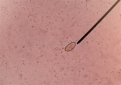 Egg Of Parasite In Stool Exam Stock Image Image Of Dangerous Insect