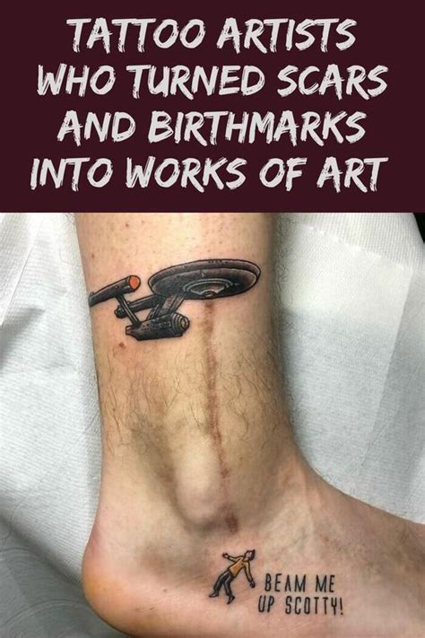 Tattoo Artists Who Turned Scars And Birthmarks Into Works Of Art Artofit