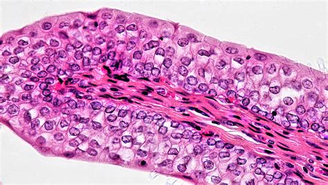 Simple Cuboidal Epithelium Labeled 400x