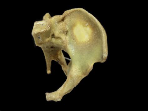 Sagittal Section Of A Female Pelvis Plastinated Specimens Female
