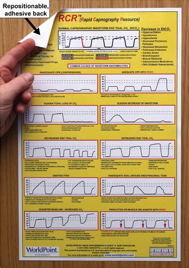 Normal And Abnormal Capnography Waveforms Infographic Capnoacademy My XXX Hot Girl