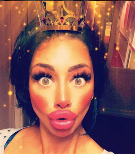 This Woman Wants To Take Her Huge Lips And Make Them Even Bigger Pics