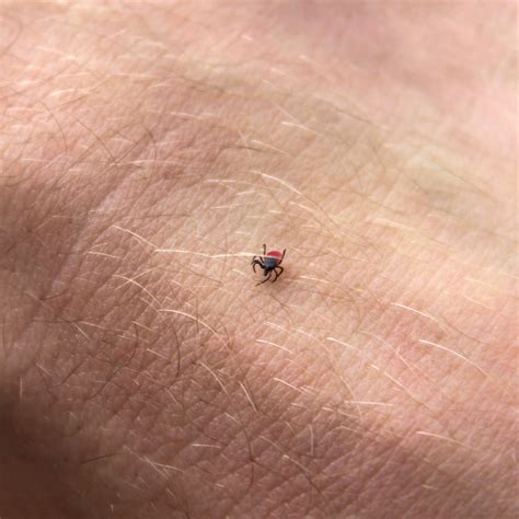 Ticks And Lyme Disease What You Need To Know Page 3 Things Health