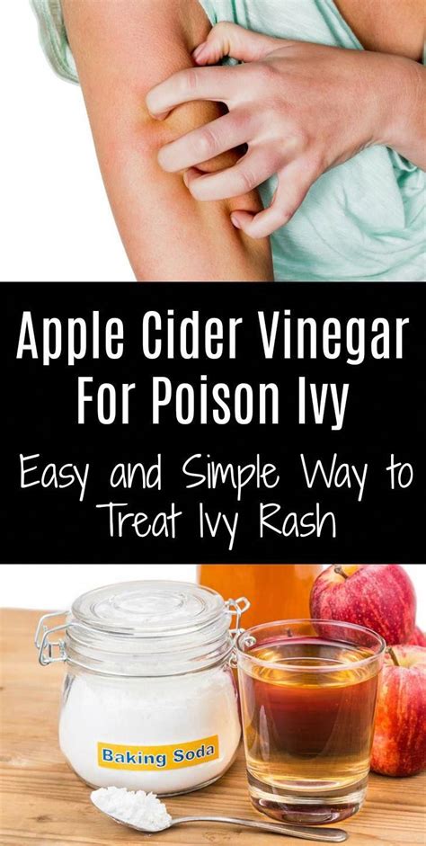 Apple Cider Vinegar For Poison Ivy Easy And Simple Way To Treat Ivy