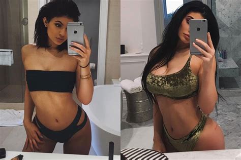Kylie Jenner Plastic Surgery Before And After N4gm