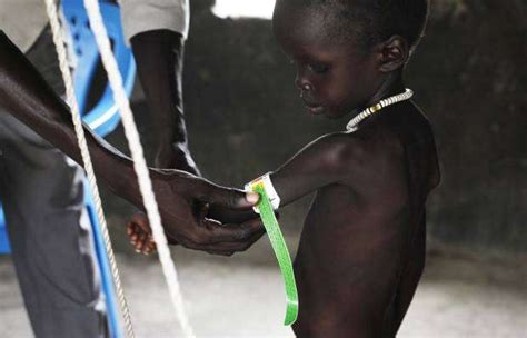 Ue Quer Apoiar O Combate à Malnutrição Infantil Nos Próximos Anos Rede Angola Notícias