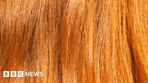 Hidden Red Hair Gene A Skin Cancer Risk Bbc News