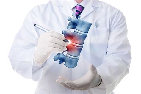 Spine Surgery Mission Viejo Ca Spinal Fusion Orange County