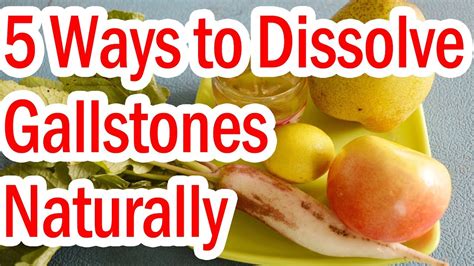 Is it possible to remove it naturally as prescribed give me valuable advice. How to Dissolve Gallstones Naturally - 5 Ways - YouTube