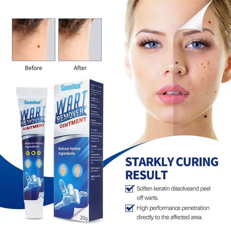 Wart Removal Cream Instant Blemish Removal Gel Effective And Safe