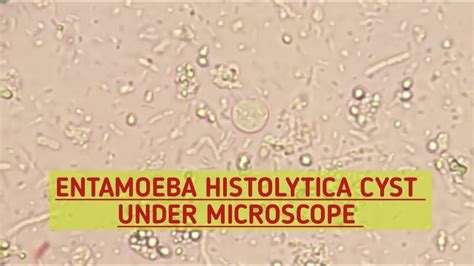 Entamoeba Histolytica Cyst Parasite In Stool Entamoeba Sexiezpicz Web