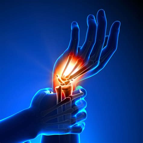 Wrist Sprain Treatment Sport Orthopedics Dallas And Frisco Tx