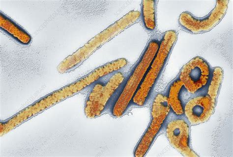 The current outbreak of marburg has a fatality based on past outbreaks of marburg (such as the 1967 marburg, germany episode that prompted the virus's name), the fatality rate usually ranges. Marburg virus, TEM - Stock Image - C002/3020 - Science ...